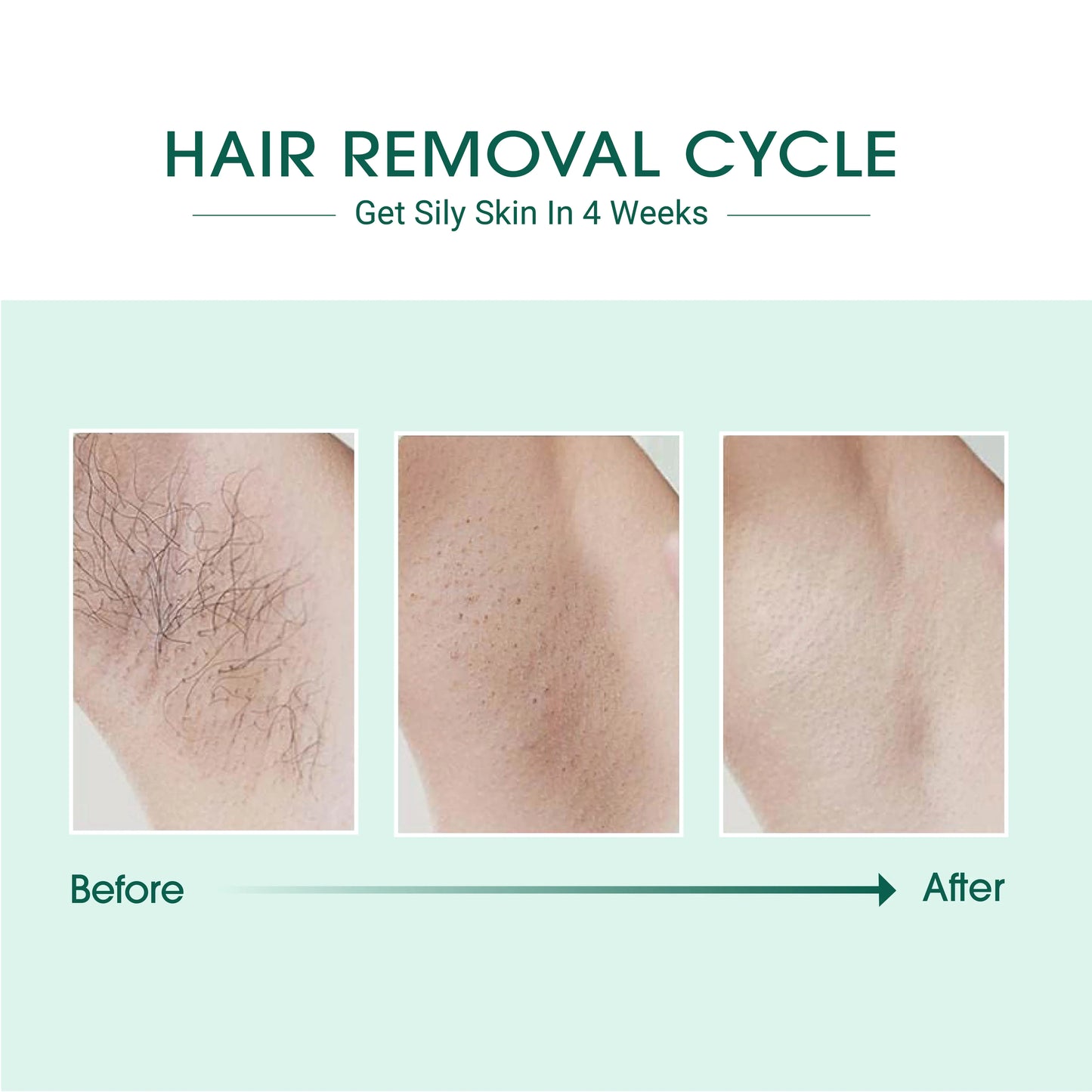 Laser IPL Hair Removal - Everpeakgoods